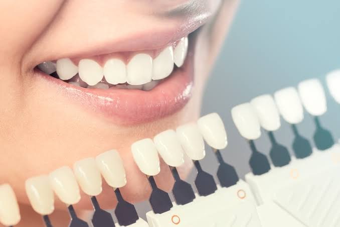Cosmetic Dentistry at Smile Design Studio