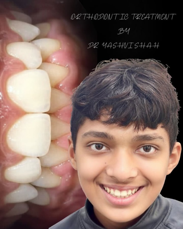 Orthodontic treatment patient smiling after treatment