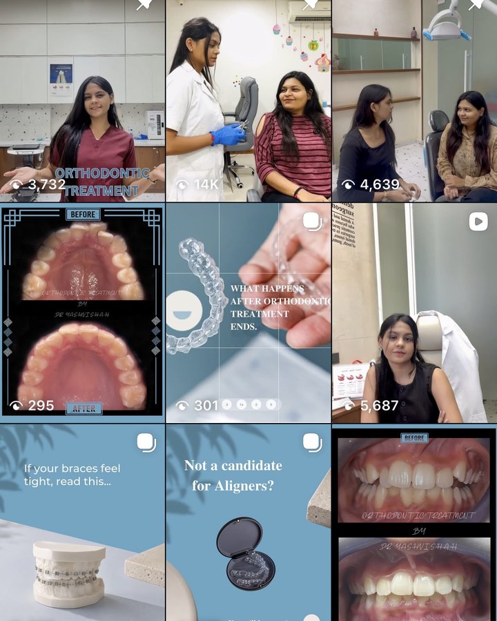 Instagram reel from Smile Design Studio showing patient orthodontic treatments