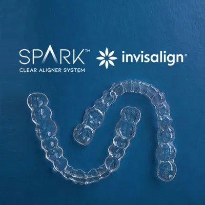 Invisalign and Spark clear aligners