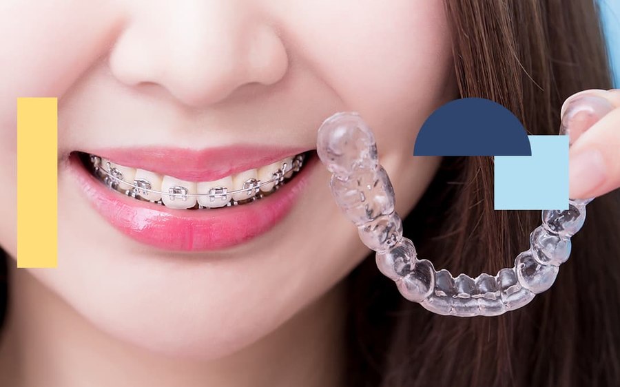 Orthodontics at Smile Design Studio